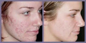 derma active before and after