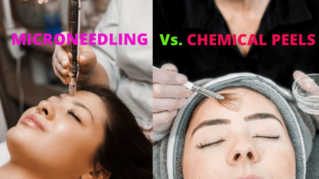microneedling vs chemical peel